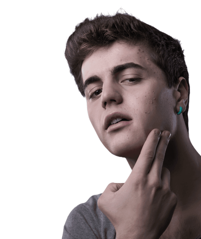 Organic Anti-Acne Facial Moisturizer - FOR MEN - Onyx Skin Care Line
