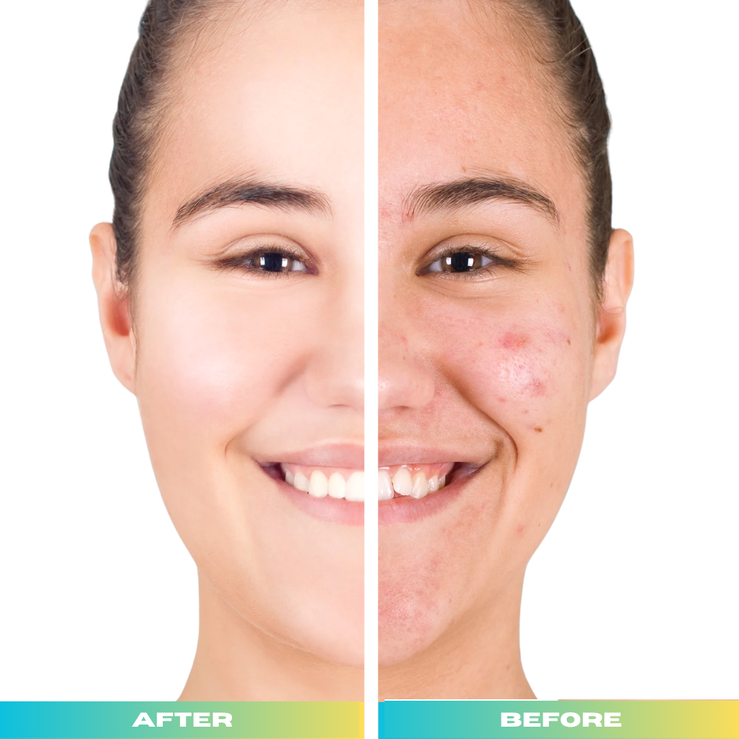 Organic Anti-Acne Nourishing Facial Wash - For WOMEN