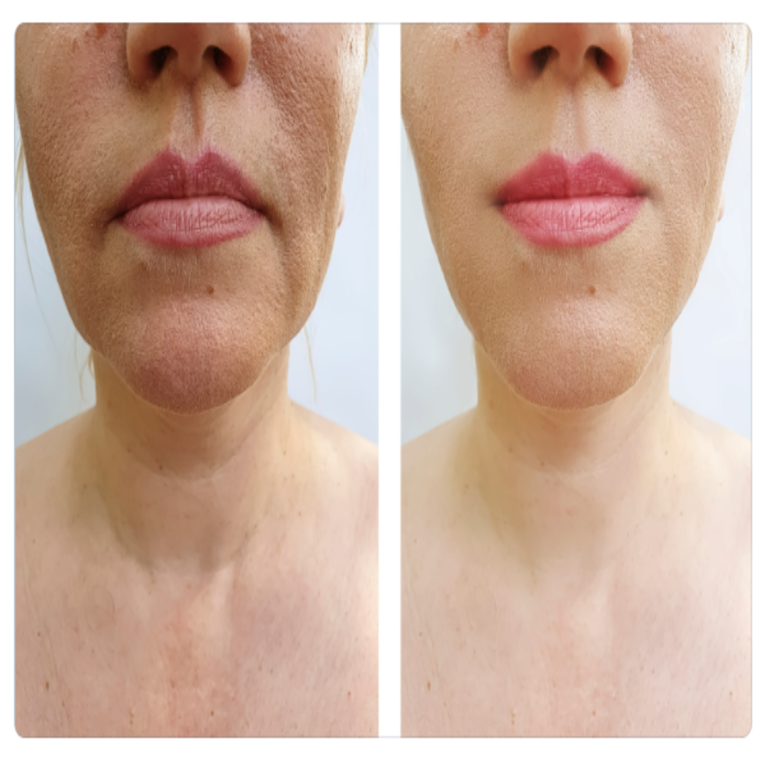 ORGANIC NECK RENEWAL CREAM - For Women