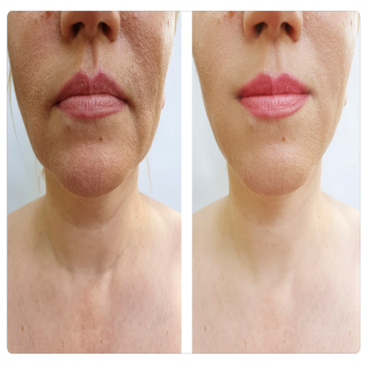 ORGANIC NECK RENEWAL CREAM - For Women