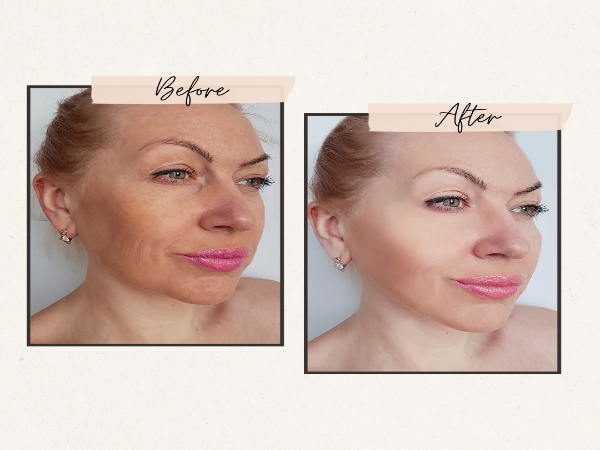 Anti-Aging Organic Facial Moisturizer - FOR WOMEN
