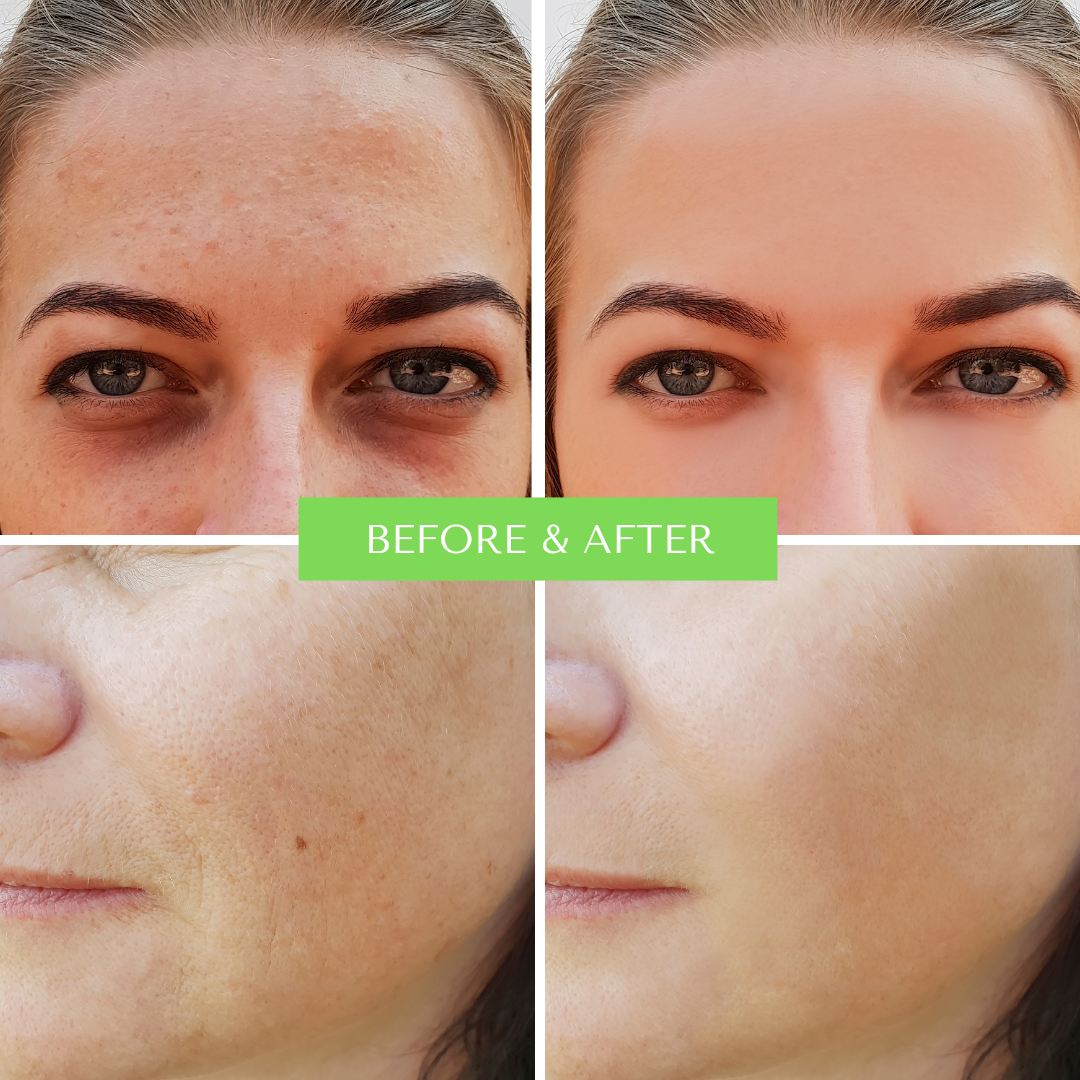 ORGANIC HYALURONIC WRINKLE DEFIER -  For Women and Men